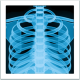 X-ray emoji, Apple, iOS 16.4