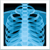 X-ray emoji, Apple, iOS 26
